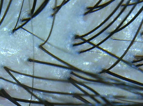 マイクロスコープ